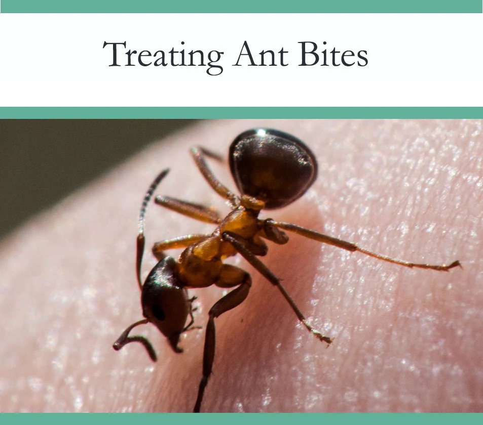 Howto treat ant bites
