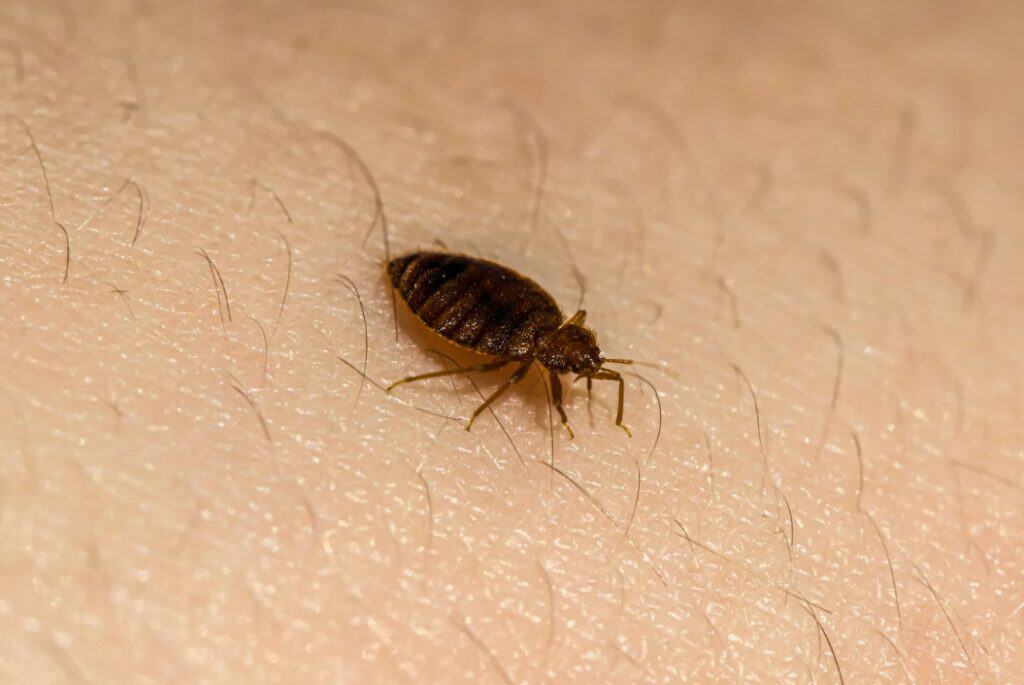 bed bug bites and how to spot an infestation early