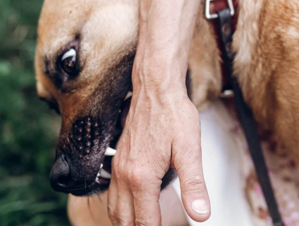 number of dog bite injuries in california